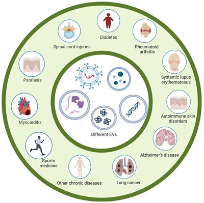Editorial: The immunological regulation of extracellular vesicles on chronic diseases
